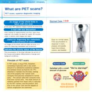 What are PET Scans?