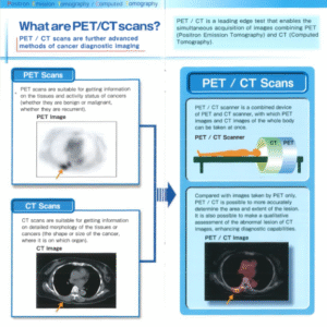 What are PET/CT Scans?